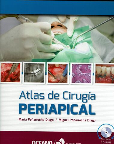 ATLAS DE CIRUGIA PERIAPICAL