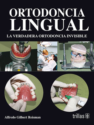ORTODONCIA LINGUAL