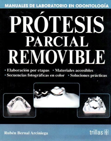 PROTESIS PARCIAL REMOVIBLE