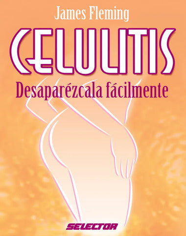 CELULITIS