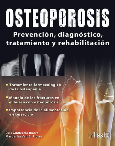 OSTEOPOROSIS PREVENCION DIAGNOSTICO TRAT