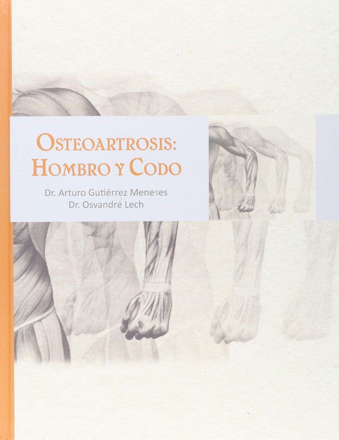 OSTEOARTROSIS HOMBRO Y CODO