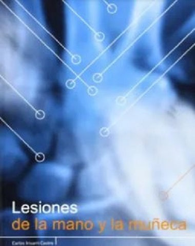 LESIONES DE LA MANO Y LA MUÑECA