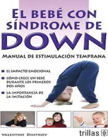 BEBE CON SINDROME DE DOWN, EL
