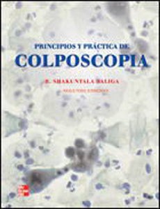 PRINCIPIOS Y PRACTICA DE COLPOSCOPIA